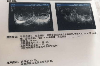 会算数的胎儿，早期智力发展研究取得新突破