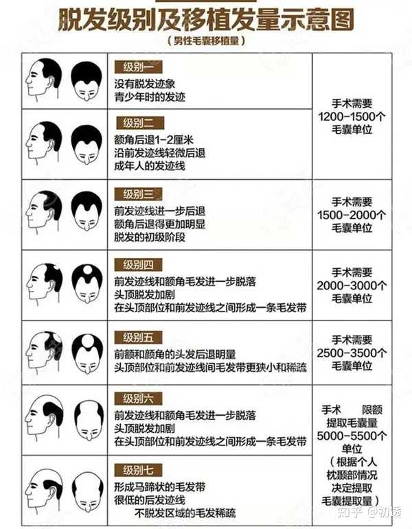 最新植发价格解析，费用因素与个性化选择全攻略